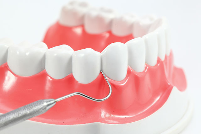 一般歯科イメージ